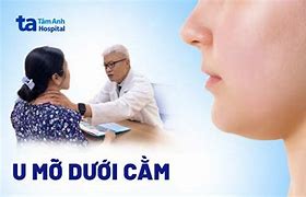 Cục U Nhỏ Dưới Cằm